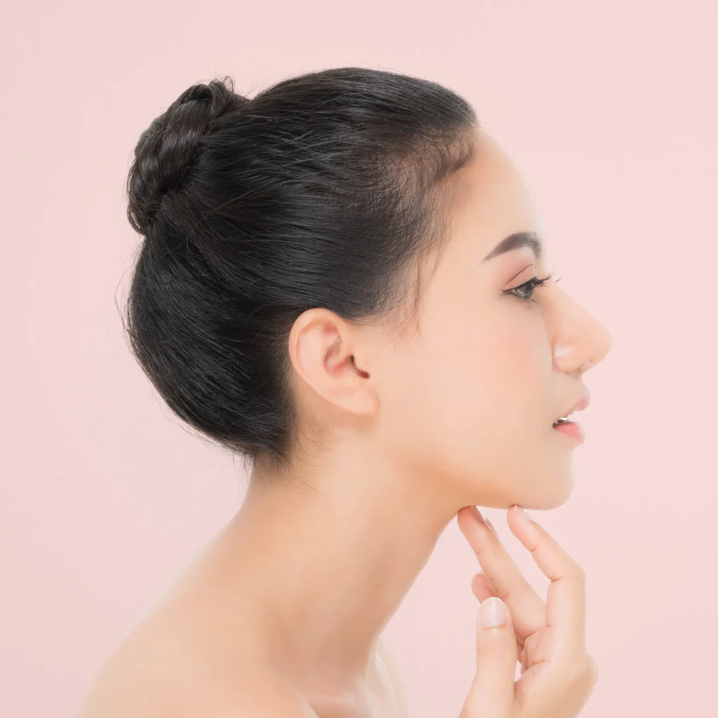 How Kybella Recasts Your Jawline