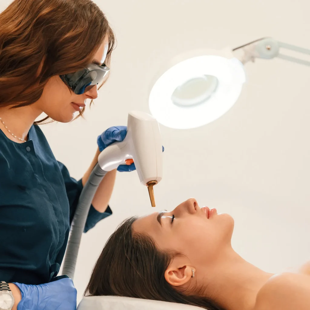 Fractional Laser Treatment