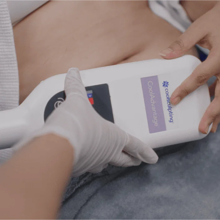 Are-You-a-Good-Fit-for-CoolSculpting