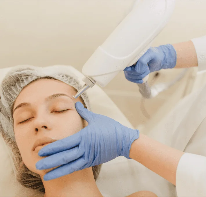 CO2 Laser Skin Treatment