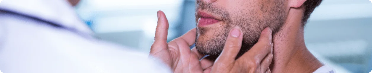 kybella-price