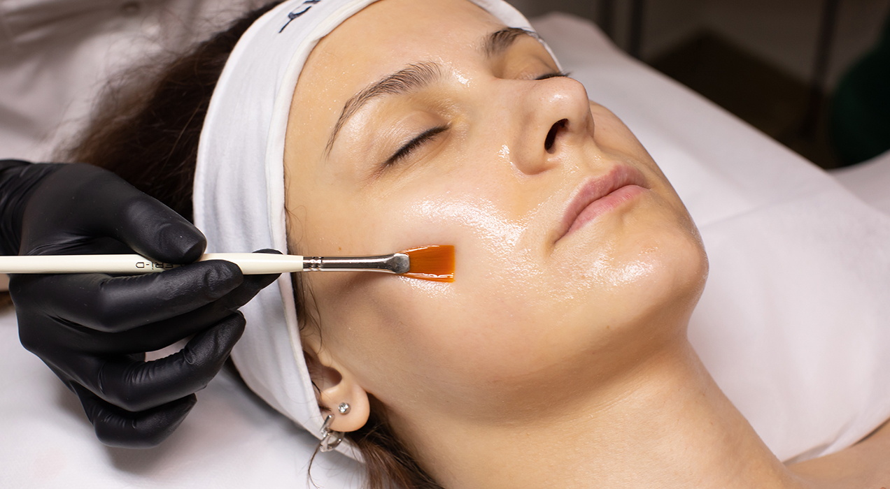Glycolic Acid Peel