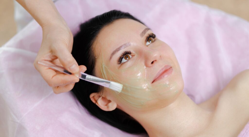 Chemical Peel