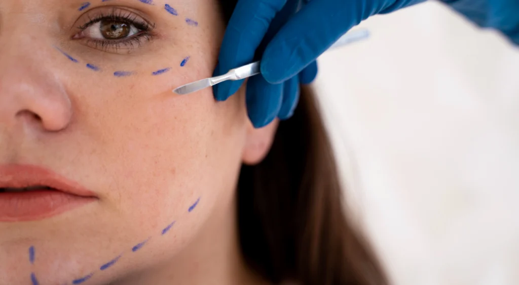 FaceTite – Non-Surgical Facelift Alternative