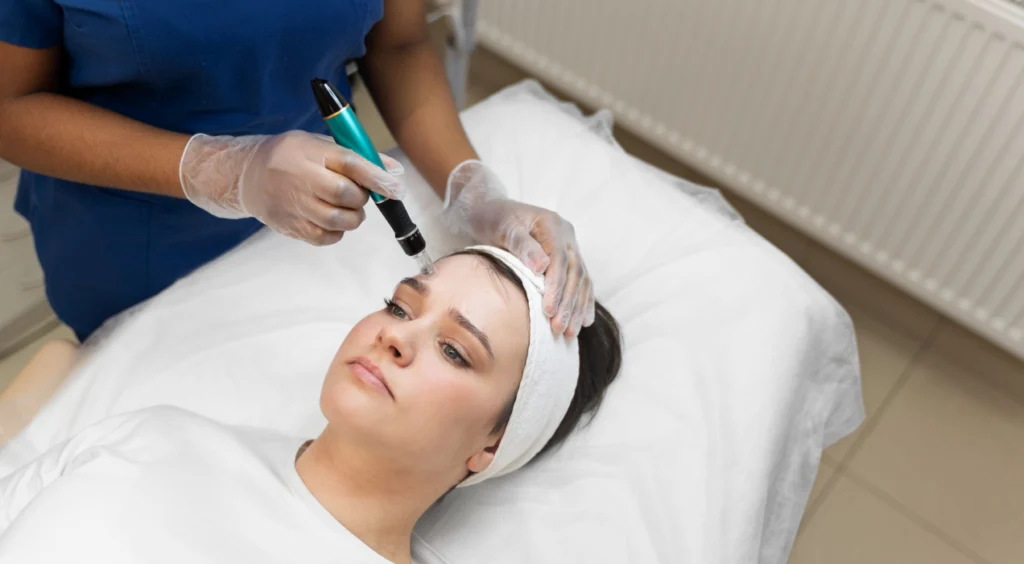 HydraFacial for Acne