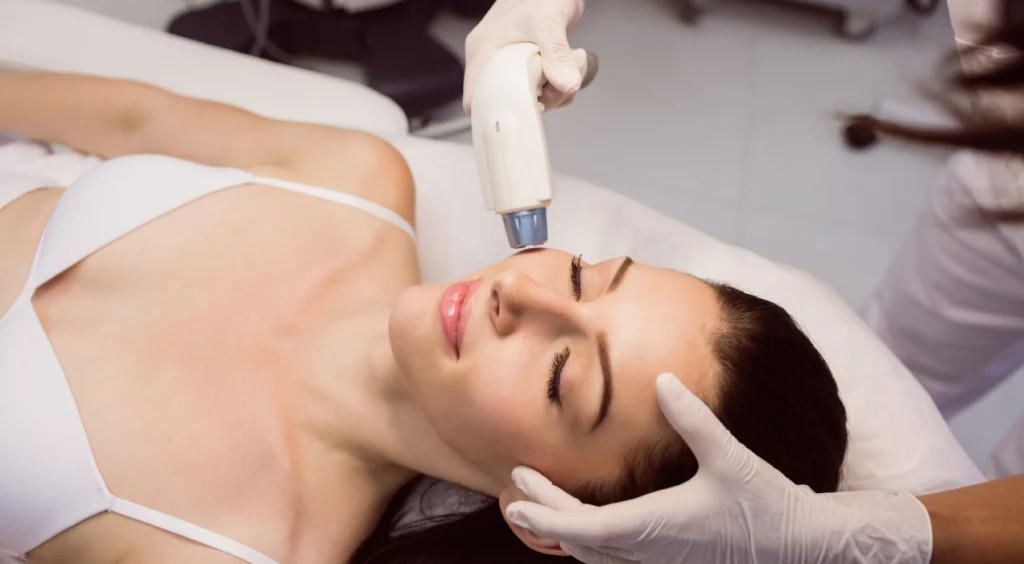 Laser Skin Resurfacing