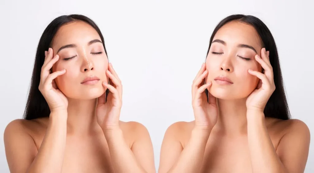 Why Choose Radiance Aesthetic Medicine in Atlanta